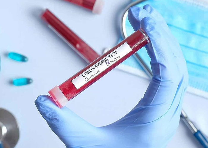 هشدار وزارتبهداشت درباره ورود مدعیان طب سنتی و اسلامی به بحران کرونا